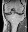 四肢領域MRI画像